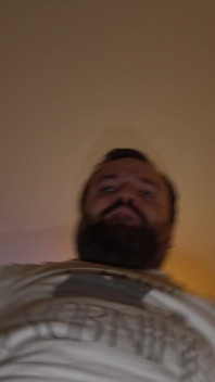 Hairy Ass, Balls and Dick of a Midget Close up