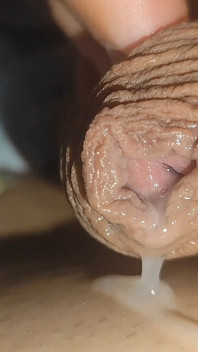 Masturbace a výstřik přes kůži Phimosis!