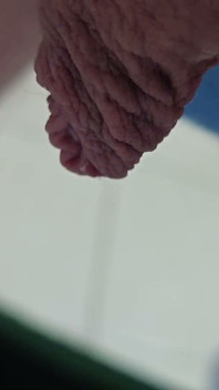 Macro Long Foreskin Sikanie