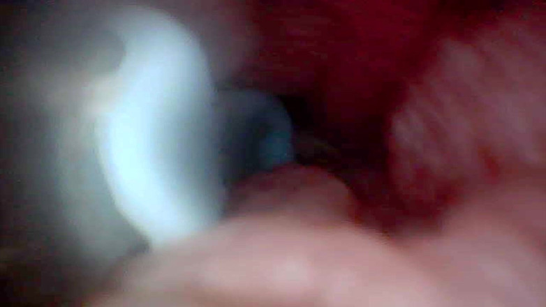 Twittiy: Laten We Samen Een Kijkje Nemen in Mijn Sappige Poesje (endoscoopcamera)