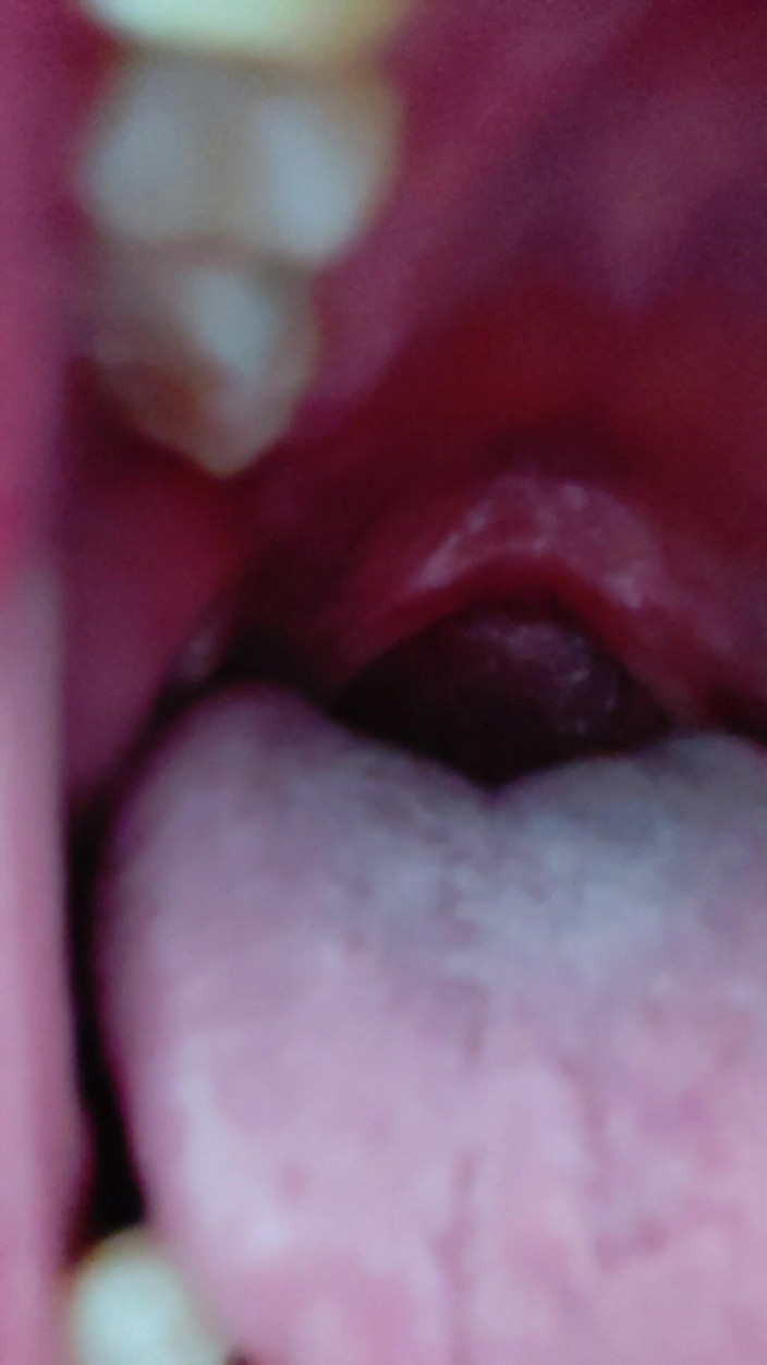 AngYourDirtyCanadian: Close up of My Mouth and Tongue