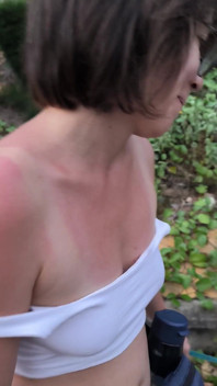 She Really Likes to Sunburn