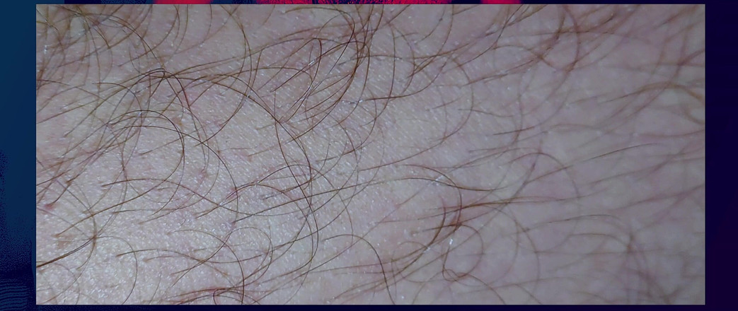 Stink HairyMale: Масковані — Ноги та чоботи