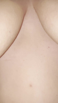 Cracked Nipples Check
