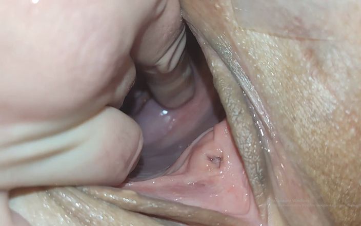 Lizaveta: Cervix for Namsei Close-up