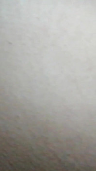Kesan Pancutan muka Bhabhi Desi