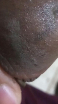Pennis After Sex