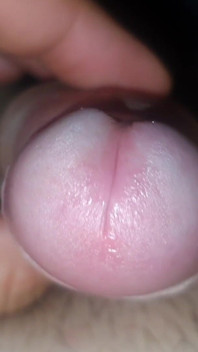 Dick Erection