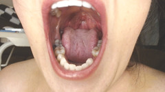 Abby Anna: Hrdlo a ústa Plivá řetězce Uvula Tonsils Uvula