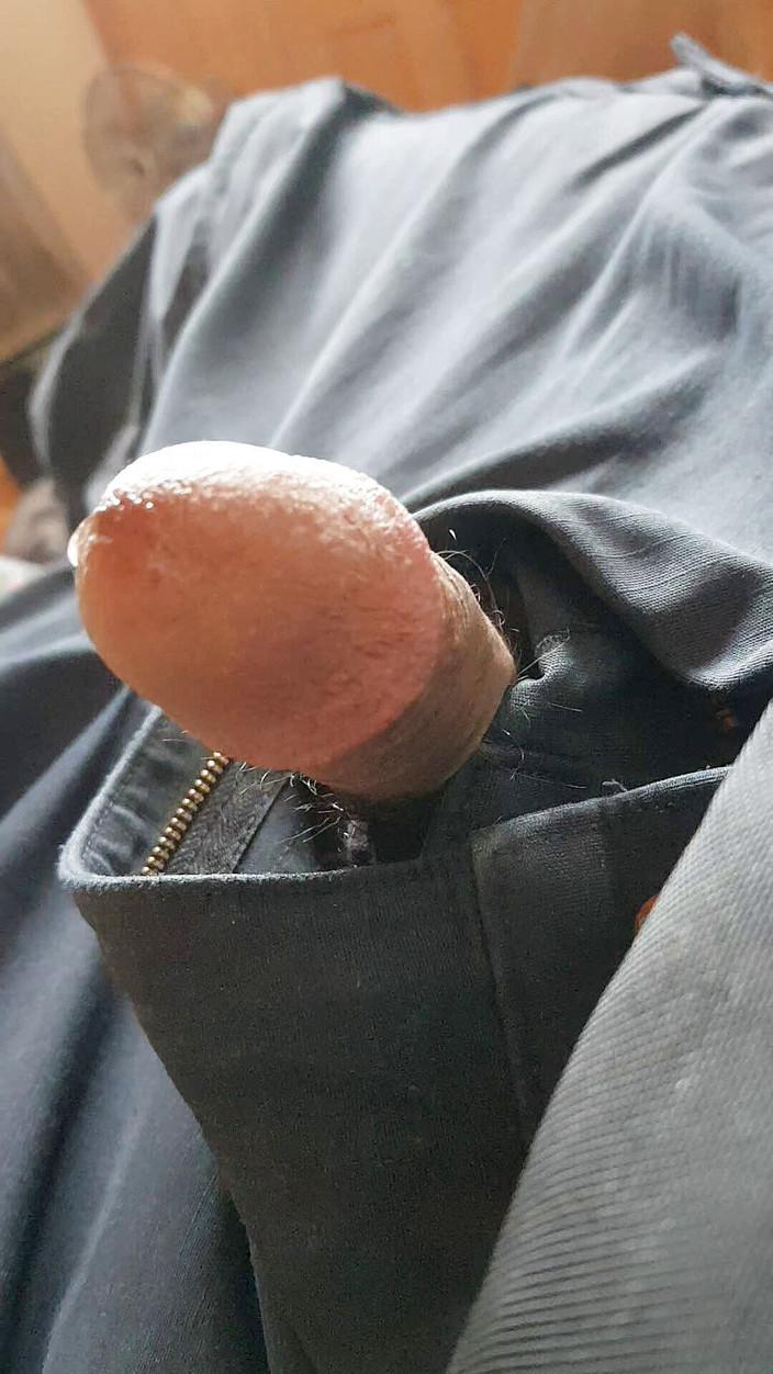 Alejandro Vazquez Flores: Gra cewki moczowej