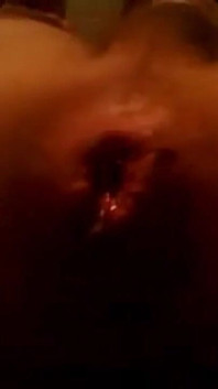 Çektiğim ilk anal sarkma videom