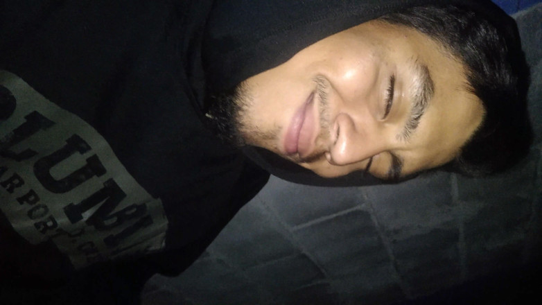 AlexAlejandro13: Tirando a gordura do meu pênis