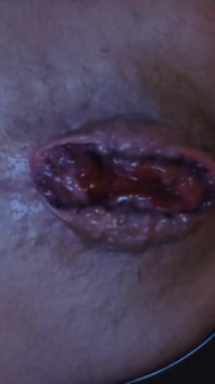 My Hole