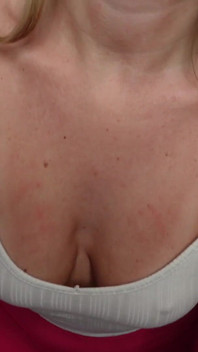 Homewrecking Physio Gives Happy Ending