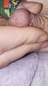 Blocked Nipple Check