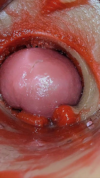 กล้องลึกในหี จับภาพน้ำสเปิร์มพุ่งทะลักแบบโอเวอร์โดส ASMR