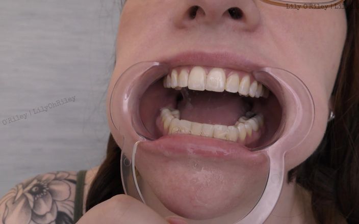 Lily O'Riley: Kính và gape: Drool kéo dài 11 phút nha khoa speculum