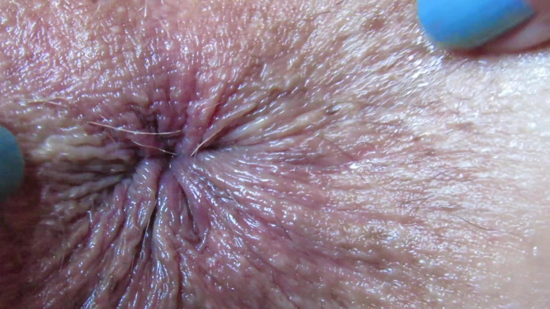 Cuteblonde666: Záběr zblízka na anální hru, hluboké prstění zadku fetiš