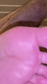 Figliastra di perforazione anale parte 1