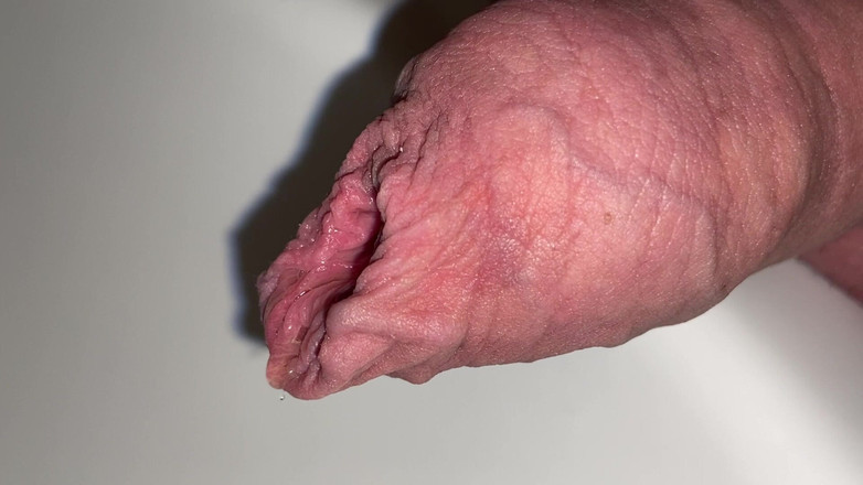 Foreskinguy: Chcaní předkožky a výstřik