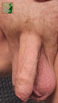 Here Is My Penis and Balls Part Two