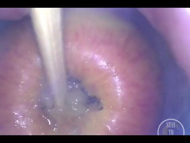 Lina Free: Punto di vista della mela che entra nel suo culo