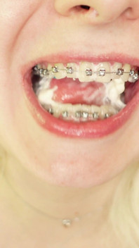 Mâncând în aparat dentar, fetiș cu alimente Video Devora