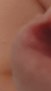 Amazing Closeup of the Widened Hole!!