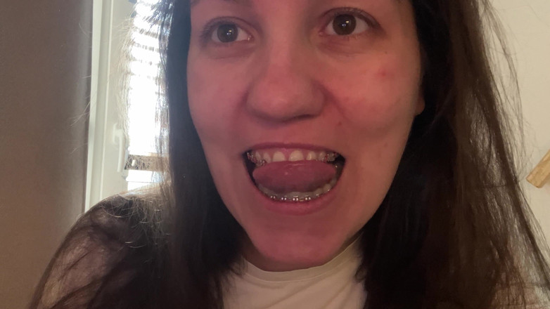 NicoleRay: Oblizywanie Językiem Aparatu Na Zęby