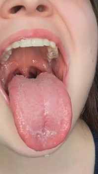 앨리슨의 입 검사와 침 놀이