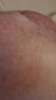 Grosses plombages Grosses boules
