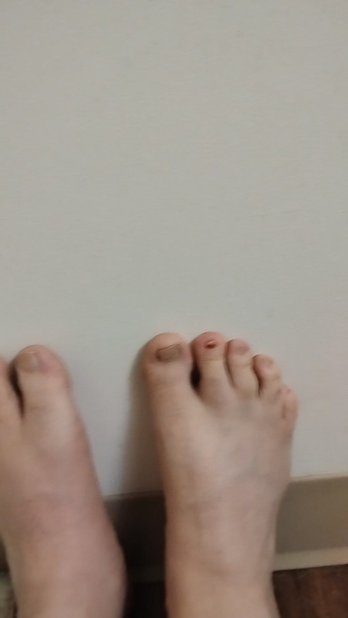 JG Risk: 11-26-2025 Słodkie małe palce