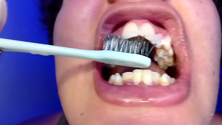 Elimoon: Cepillarme los dientes y mostrarte mis dientes (primer plano)