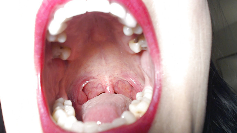 Abby Anna: Velká doširoka otevřená ústa