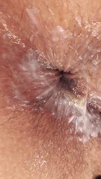 Matura sodomizzata - coppia amatoriale fatta in casa - sesso anale sborrata sul culo creampie anale - video completo
