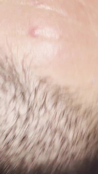 Facesitting