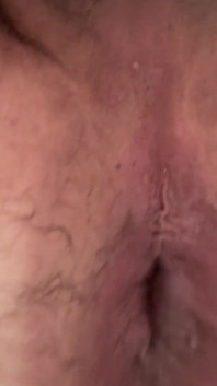 Anal Gape
