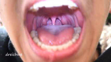 Dreichwe: Uvula fetish mouth
