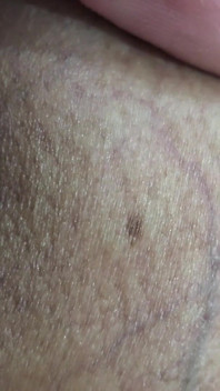 What Is That on My Penis