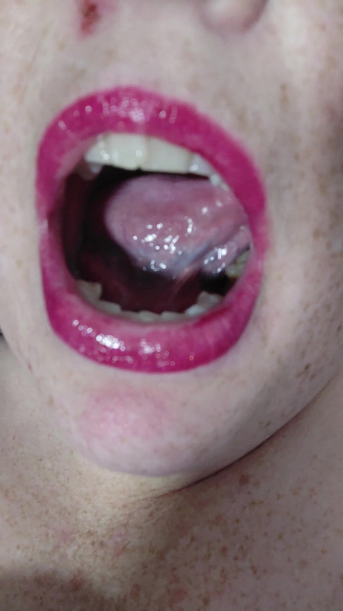 AngYourDirtyCanadian: Playing with My Tongue