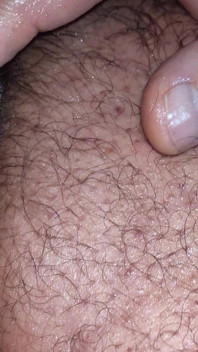 Anal Masturbation