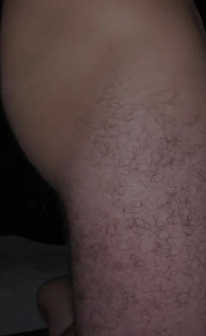 Broken holes cuckold gay: Haar Vriend Bedekte Haar Ogen Zodat Ik Haar Deepthroat Zou...