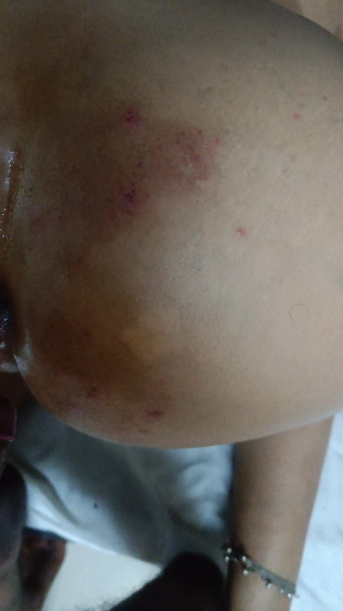 Meenu sex: Mera Phela sex videa