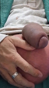 Saline - Before and After