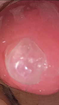 Derin amcıktaki kamera prezervatife büyük bir sperm boşalmasını kaydediyor
