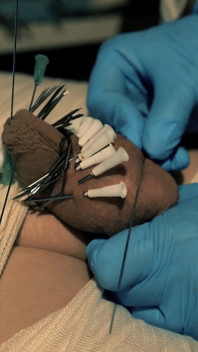 Medical Play Fun, Mummification, Needle CBT and Electro