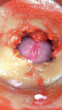 Cameră în anal col uterin cu vedere la persoana 1, micuț futut de cuplu uriaș, spermă în anal și ejaculare înăuntru - Asmr