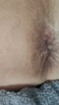 Nl Slut