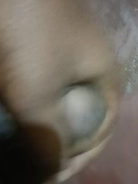 LegalVector8: Melancap