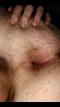 My Anal